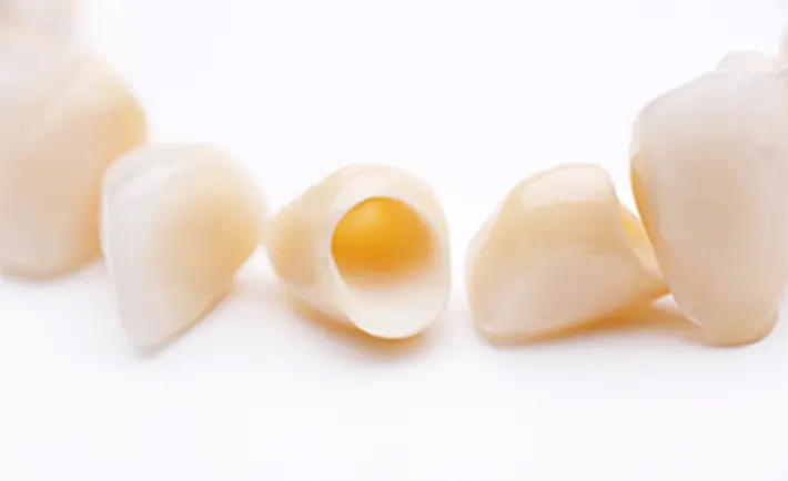 自費診療での詰め物や被せ物の素材