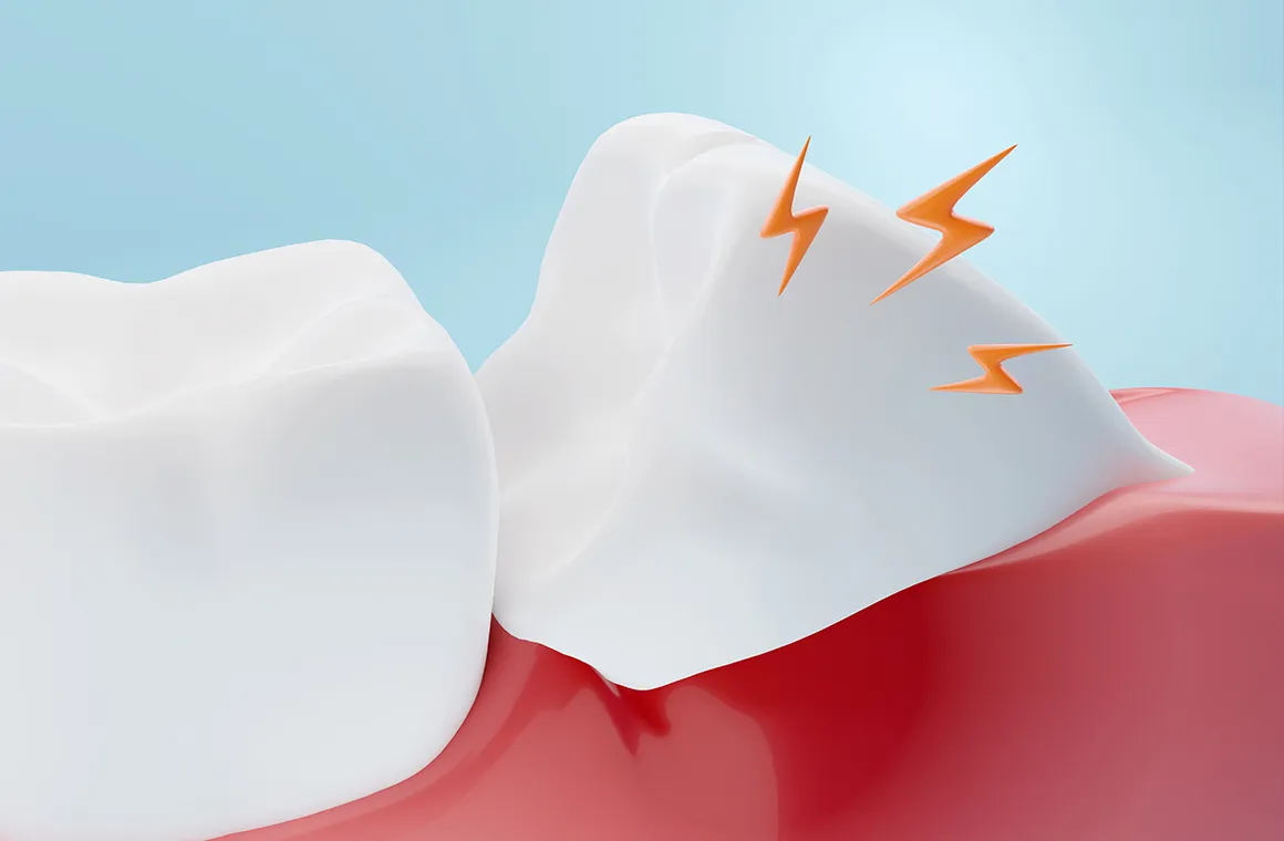 親知らずの痛みの原因について