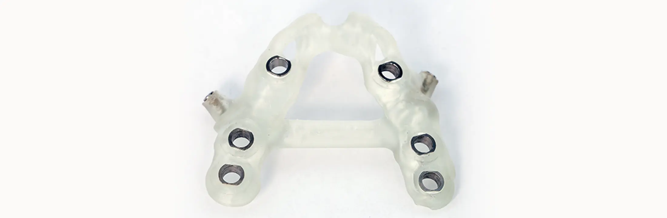 インプラントガイドシステムを使用したフラップレス手術