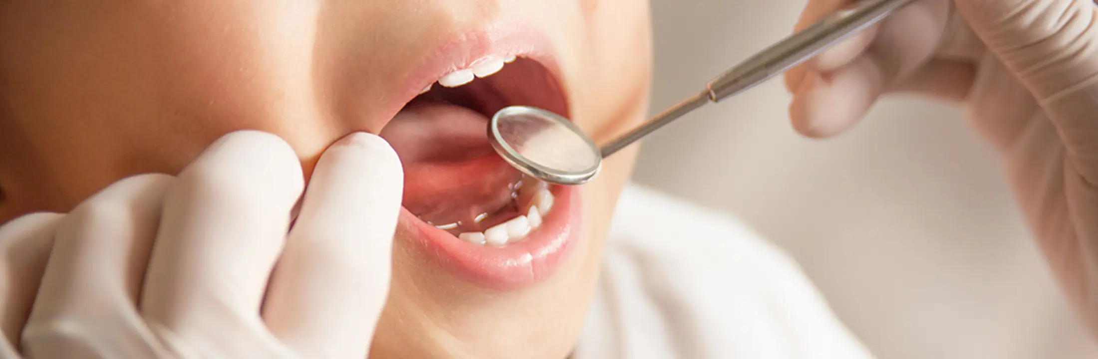 お子さまの歯を守る定期検診について