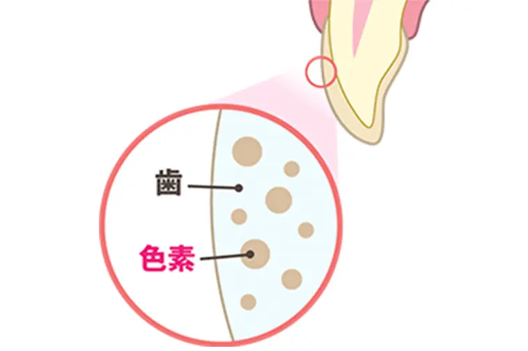 歯の色が黄色い状態